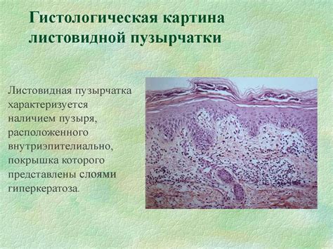 Хейлиты, пузырные дерматозы, вирусные дерматозы - online presentation
