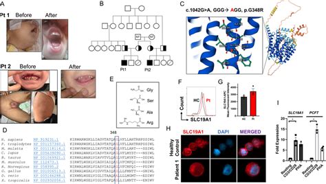 G R Substitution Does Not Alter Slc A Protein Expression A Pictures