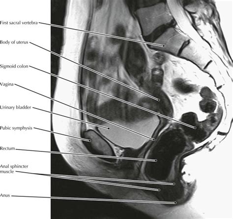 Cross Sectional Anatomy Atlas