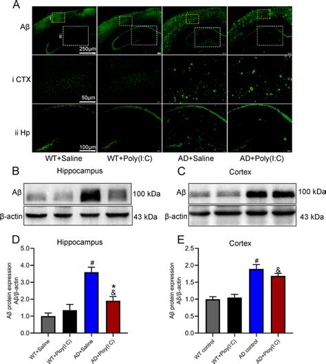 Aβ Deposition In Mouse Brains A Representative Immunofluorescence