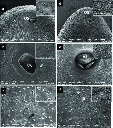 Scanning Electron Micrographs Showing The Effect Of 40 μm A B C And