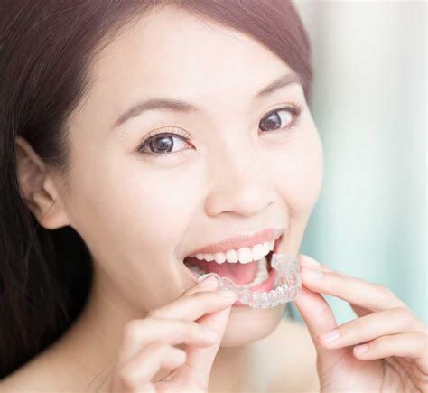 Types Of Braces Available St Marks Orthodontics Dental Treatment