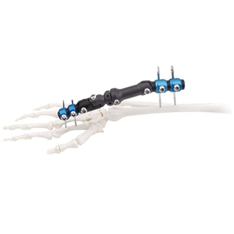 Wrist Joints External Fixator Orthopedic Drills