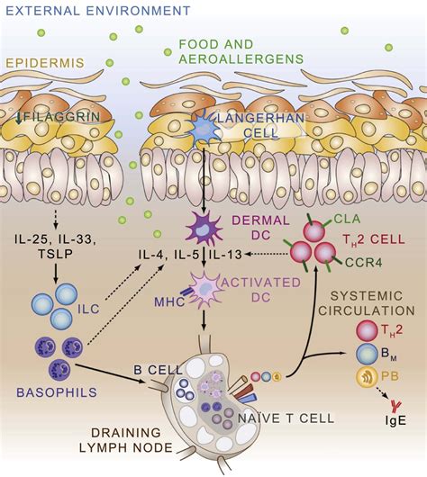 The Atopic March Annals Of Allergy Asthma And Immunology