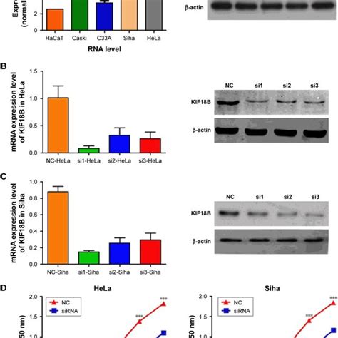 Overexpression Of KiF18B Promotes Cervical Cancer Cell Proliferation