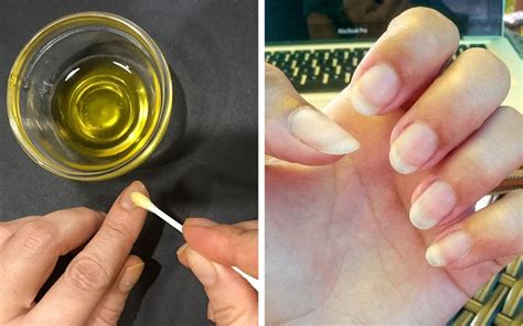 Natural Ways To Fix Your Brittle Weak Nails U As Fragiles