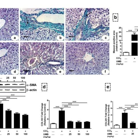 Umbelliferone Attenuates Ccl Induced Liver Fibrosis In Rats A