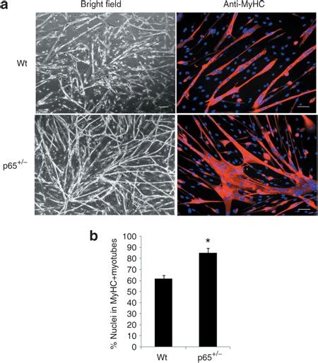 Myogenic Differentiation Is Enhanced In Muscle Derived Stem Cells