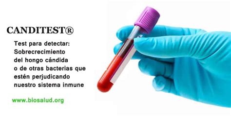 Vestir Sindicato Gracioso Prueba Para Candida Albicans Evaporar