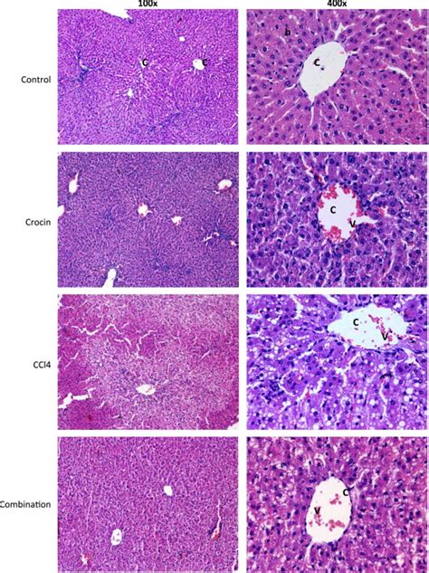 Representative Hande Micrographs From Liver Tissues Collected From Rats