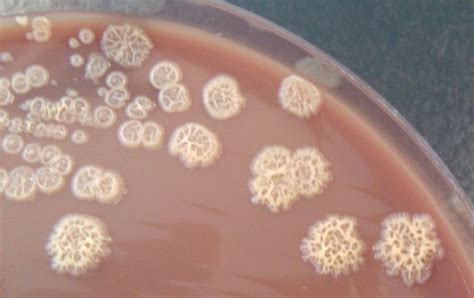 Pseudomonas stutzeri - Alchetron, The Free Social Encyclopedia