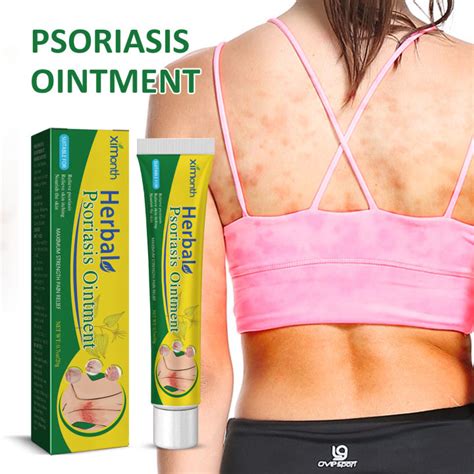 20g Ximonth Herbal Psoriasis Ointment For Relieve Psoriasis Blieve