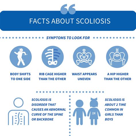 Scoliosis Causes Symptoms Treatment Osteo Health Osteopath