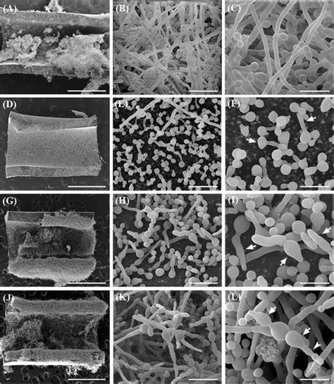 Scanning Electron Microscopy Of Candida Albicans Atcc 10231 Biofilms