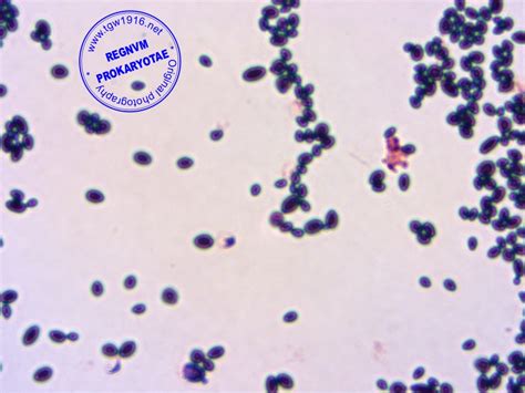 Кандида Строение – Telegraph