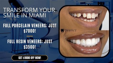 How Much Are Full Mouth Veneers Cost In The Us Factors