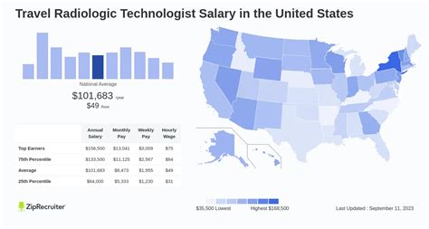 How Much Do Travel Radiologic Technologist Pay Per Week