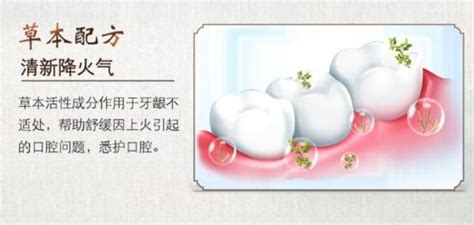 牙龈肿痛怎么办？牙龈肿痛用什么牙膏好？ 知乎