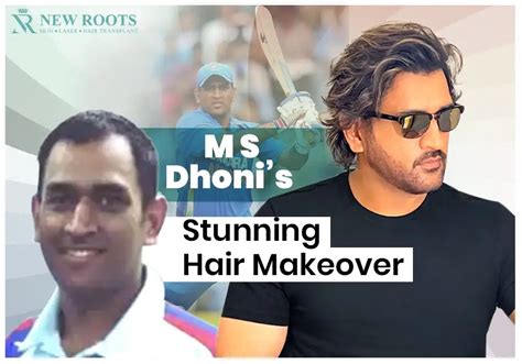 M S Dhoni Hair Transplant: A Game-Changing Transformation