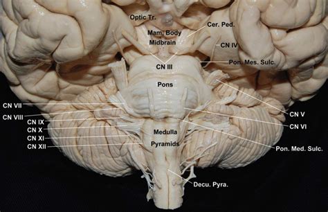 Anterior View Of The Brainstem Neuroanatomy The Neurosurgical Atlas