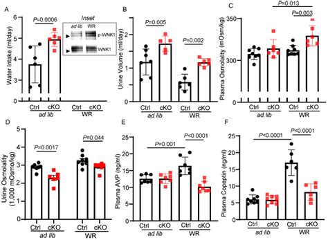 Wnk1 Cko Mice Exhibit Partial Central Diabetes Insipidus With Impaired