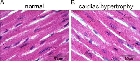 Echocardiographic And Histological Examination Of Cardiac Morphology In