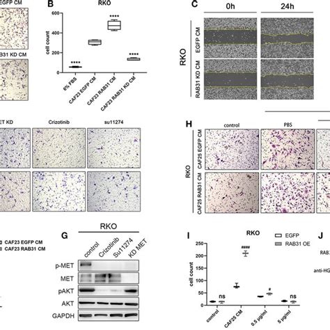 The Localization And Expression Of RAB31 In Colon Cancer A Paired