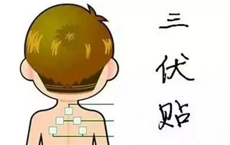 “冬病夏治”防病法，“儿童专用”配方佳 本周六，市一院中西医结合儿科“儿童三伏贴”开贴啦！山东省济宁市第一人民医院