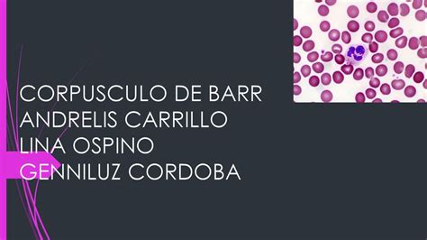 Corpusculo De Barr Andrelis Carrillo Lina Ospino Genniluz Cordoba Ppt