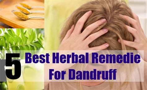 5 Best Herbal Remedies For Dandruff Natural Home Remedies And Supplements