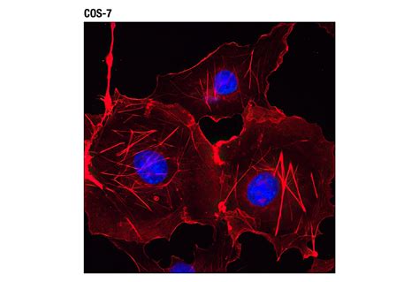 β Actin 13e5 Rabbit Mab Alexa Fluor® 594 Conjugate Cell Signaling