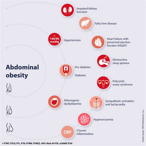 Metabolic Syndrome A New Definition And Management Guidelines A