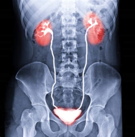 2900 Nephron Stock Photos Pictures And Royalty Free Images Istock