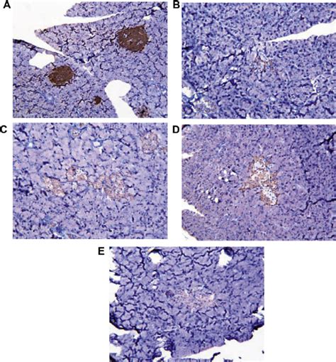 E Immunohistochemistry Findings For Pancreas From A Normal Control