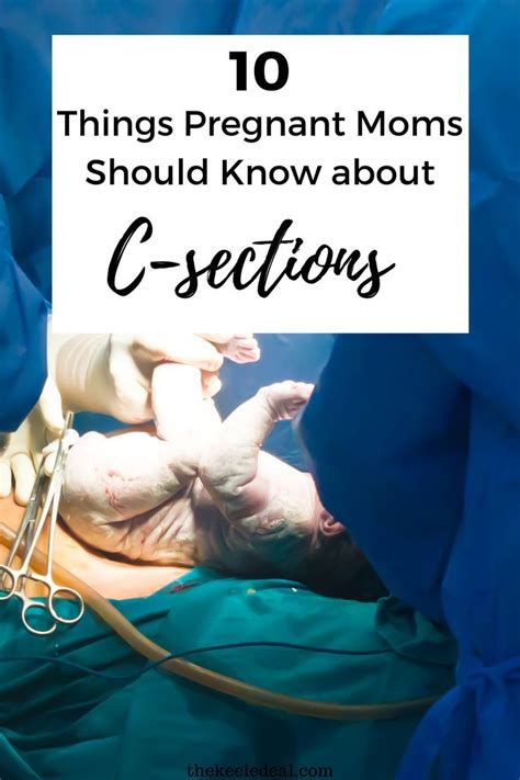 10 Things Pregnant Moms Should Know About C Sections In 2020 Pregnant Mom Cesarean Pregnant