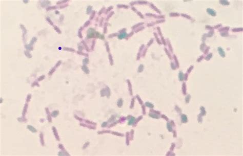 Acid Fast And Endospore Staining Microbiology Laboratory Manual