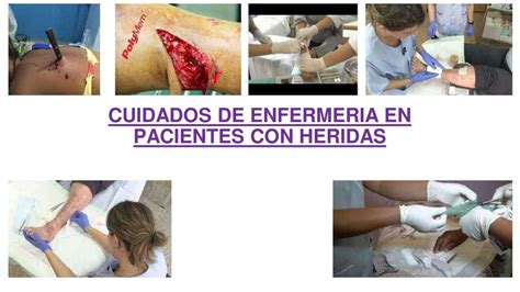 Cuidados de Enfermería en Pacientes con Heridas Duberly alfonso