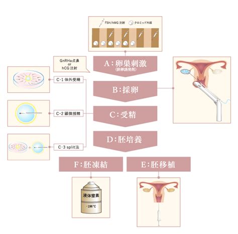 体外受精の流れ｜横浜市にある不妊症・不妊治療・体外受精専門の田園都市レディースクリニック