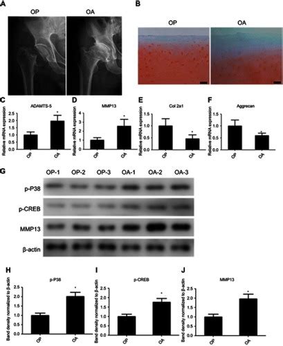 Full Article Activation Of The P38 Creb Mmp13 Axis Is Associated With Osteoarthritis