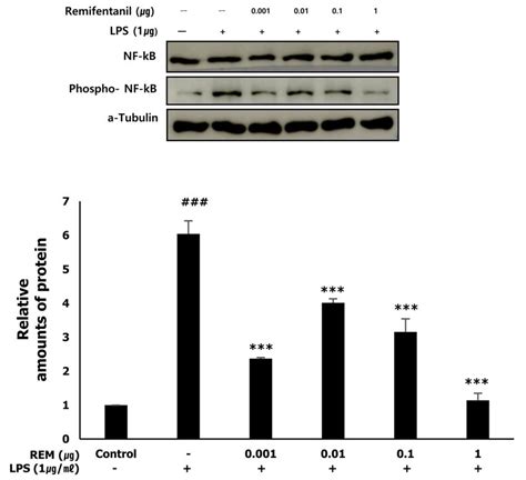 Preconditioning with remifentanil reduced NF κB expression after