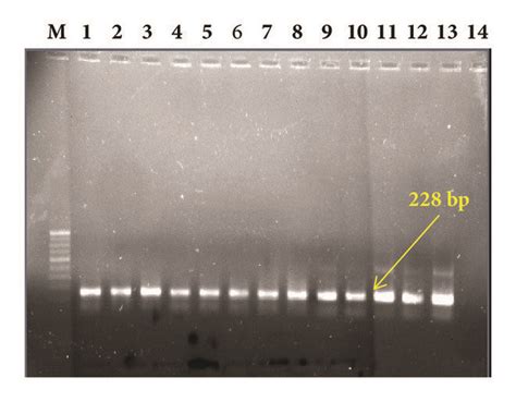 A Agarose Gel Electrophoresis Pattern For Identification Of