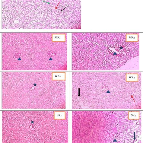 Histopathological Sections Of The Rat Kidney Hande Stain 100x Ck