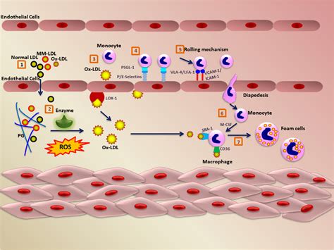 Mechanism Of LDL Oxidation And Monocyte Invasion 1 LDL MM LDL And