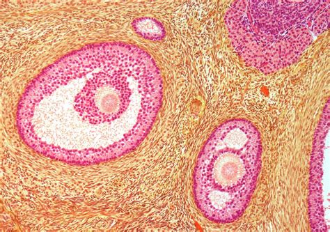 Ovarian Follicles Photograph By Steve Gschmeissnerscience Photo