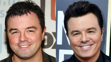 Seth Macfarlane Might Have Received Plastic Surgery To Look Younger