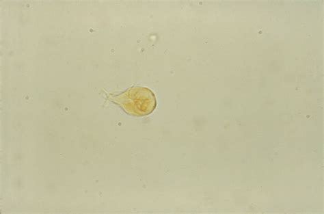 Image libre Giardia lamblia trophozoïtes petit intestin apparaît