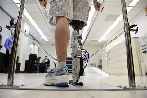 Bionic Leg Gives New Hope To Disabled People