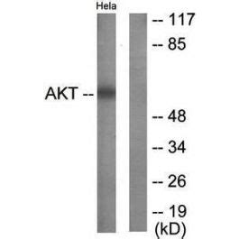 Akt Antibody Biorbyt