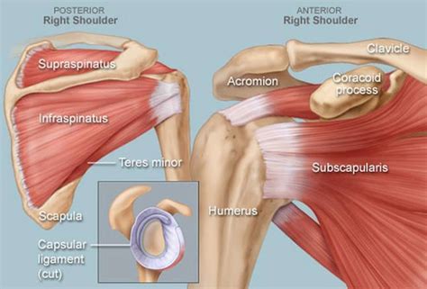 Calcific Tendinosis Causes Symptoms Diagnosis Treatment Prognosis