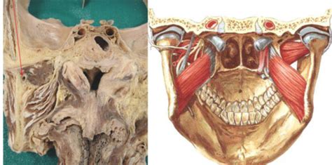 Tema Anatom A Topogr Fica De Cabeza Y Cuello Quizlet